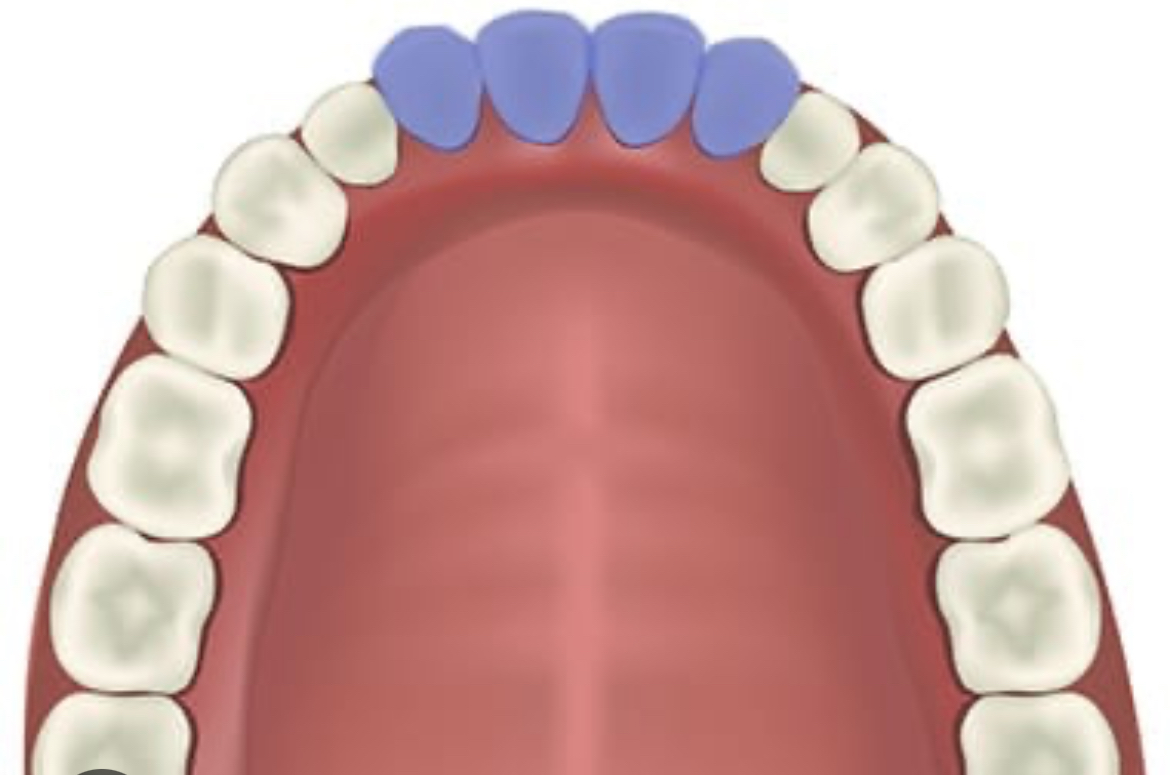 <p>Straight edges</p>