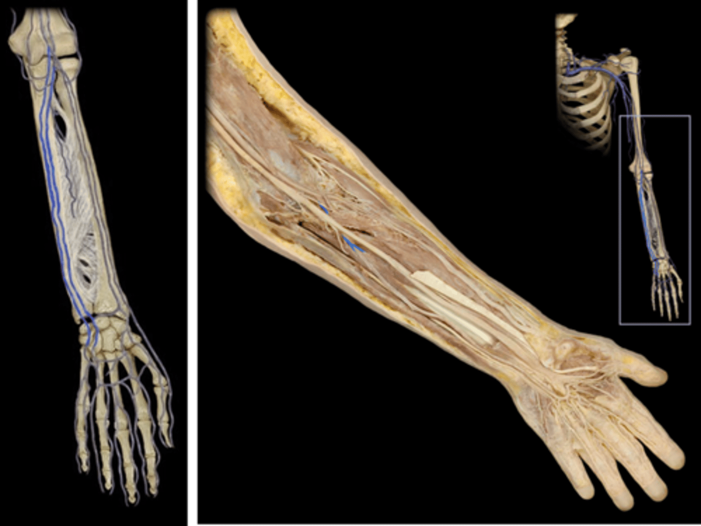 <p>Name this vessel.</p>