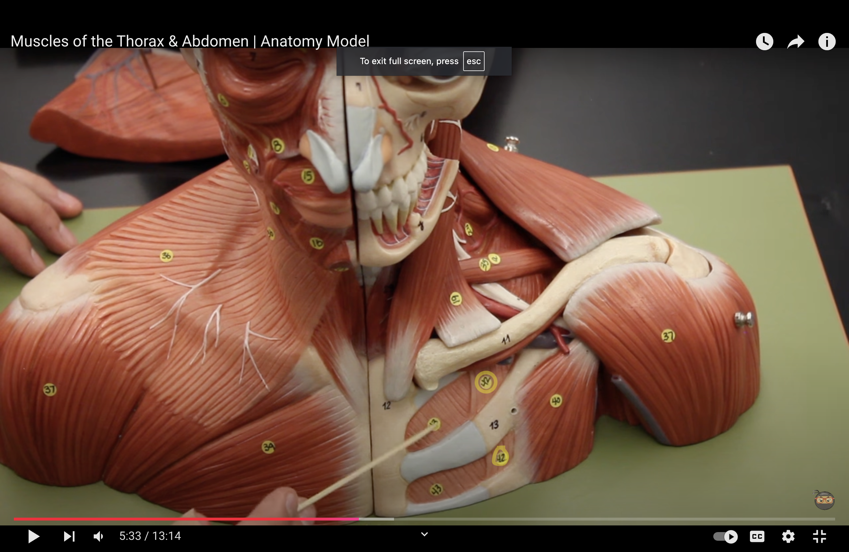 <p>What muscle is this?*****</p>