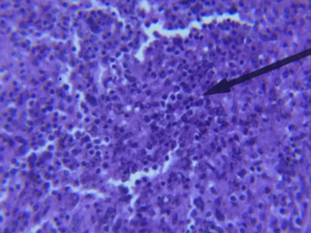 <p>what kind of tissue is this </p>