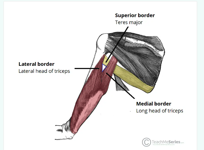 <p>Triangular interval syndrome</p>