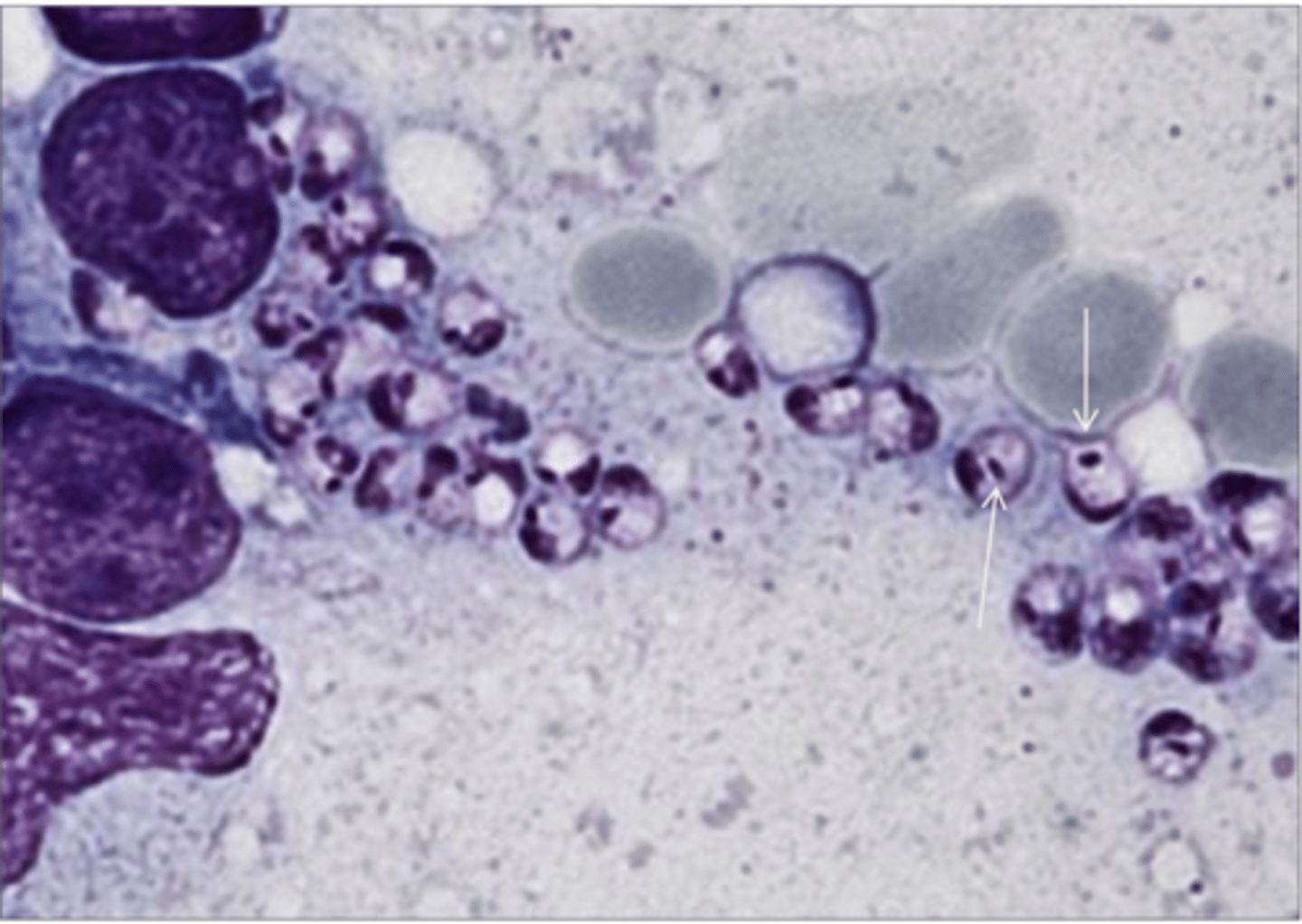<p>These abnormalities are present within the macrophages of a fox from Greece. What parasite is this?</p>