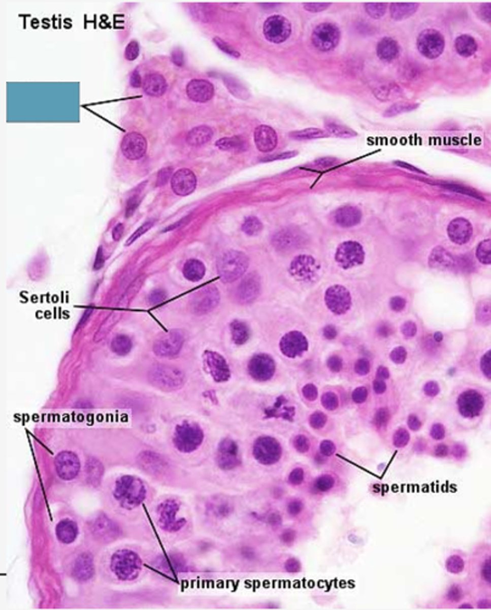 <p>Identify the cells</p>