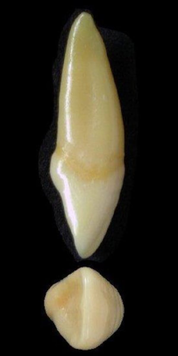 <p>what tooth is this &amp; why?</p>