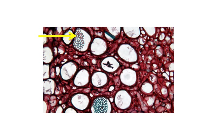 <p><span><span>What cellular structure (indicated by arrow) is seen on the end wall of the cell observable in cross section?</span></span></p><p><span><span>Companion Cell</span></span></p><p><span><span>Sieve plate</span></span></p><p><span><span>Sieve Cell</span></span></p>