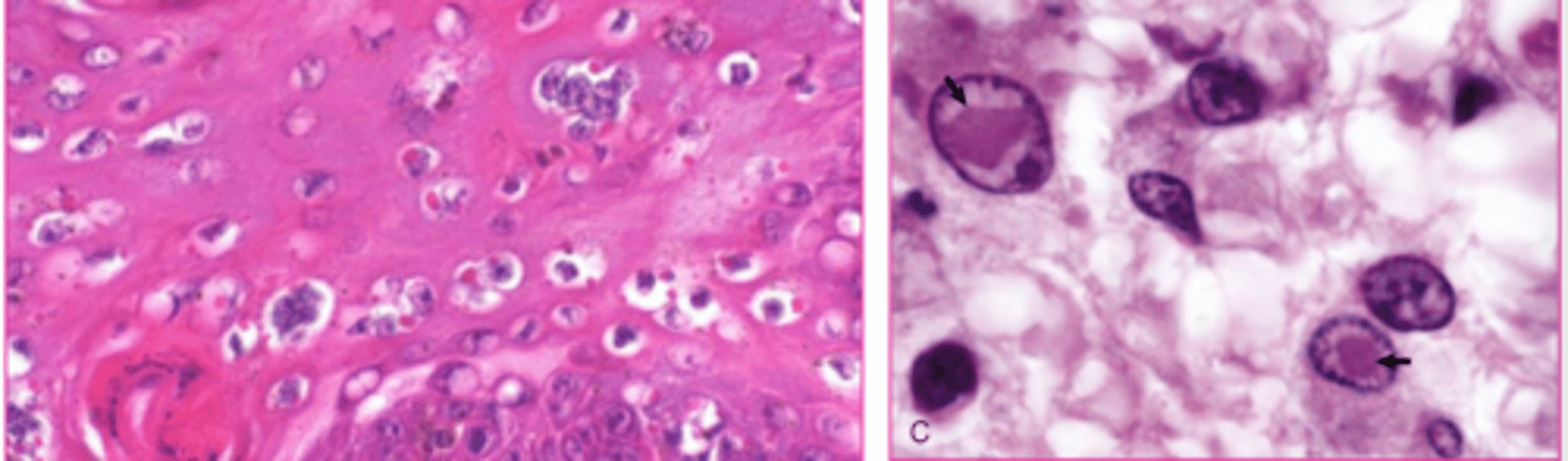 <p>which viral inclusions?</p>