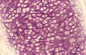 <ul><li><p><span style="background-color: transparent; font-family: "Book Antiqua", serif;"><span>Looks like hyaline but has elastic fibers in the matrix</span></span></p></li><li><p><span style="background-color: transparent; font-family: "Book Antiqua", serif;"><span>Found in ear and epiglottis</span></span></p></li></ul><p></p>