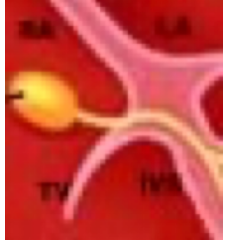 <p><span><span>The following diagram represents which one of the following functional segments of the electrical conduction system of the heart?</span></span></p>