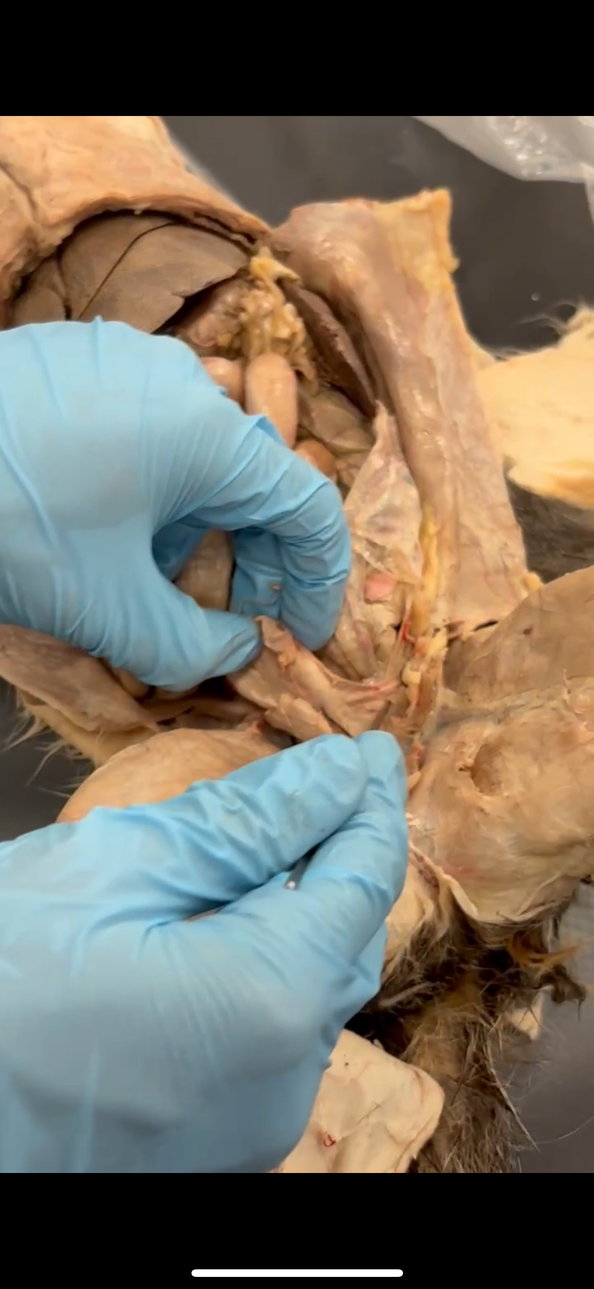 <p>Pointer points to which ligament that attaches bladder to lateral part of body</p>