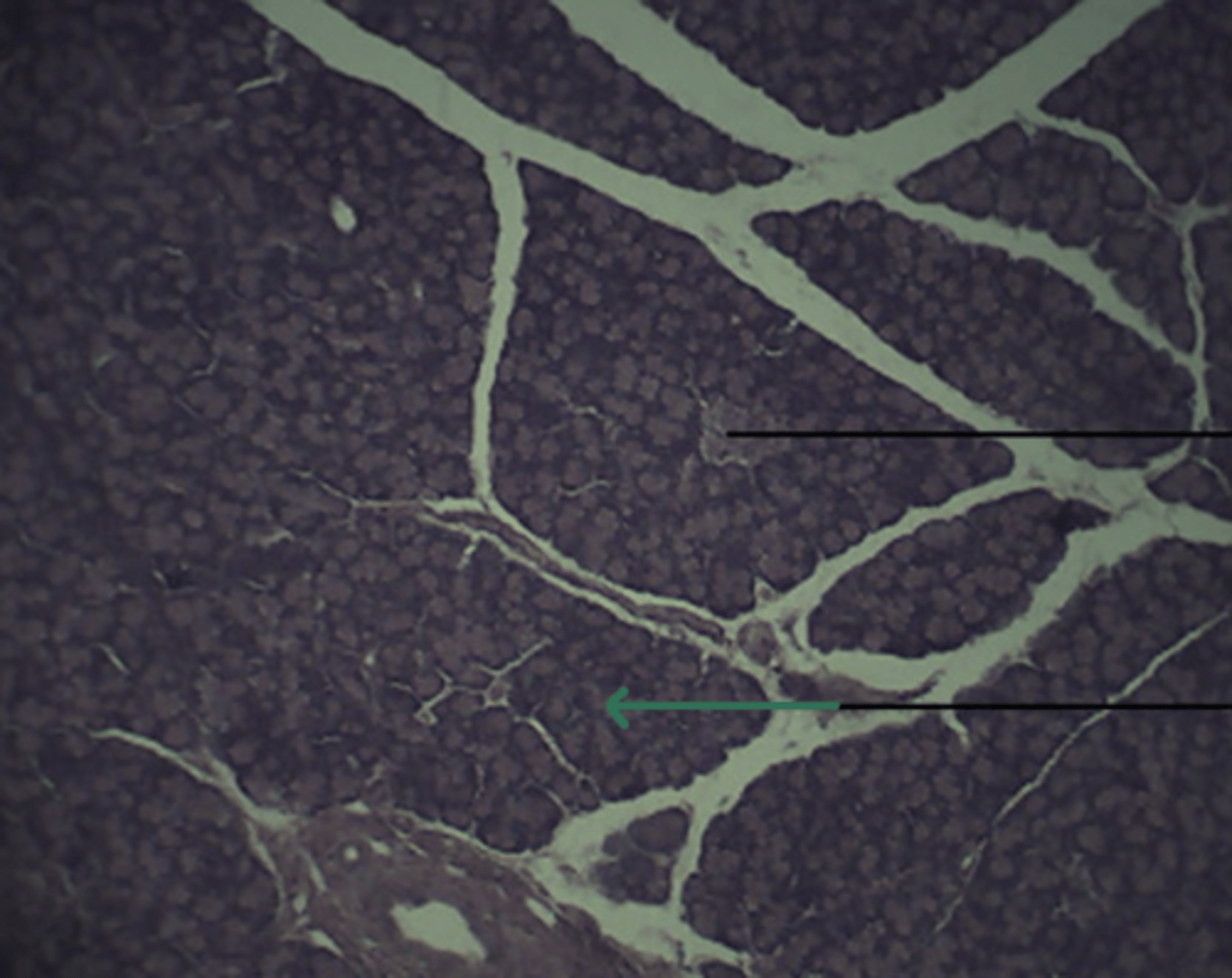 <p>gland and structure</p>