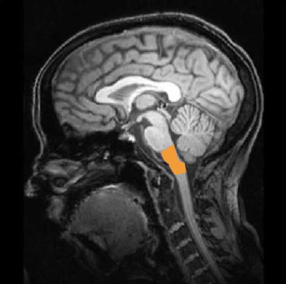 <p>most posterior region of the brain - medulla oblongata</p><ul><li><p>adjacent to spinal cord</p></li><li><p>lots of tracts (afferent signals going in, efferent going out)</p></li><li><p>damage here is often fatal</p></li></ul><p></p>