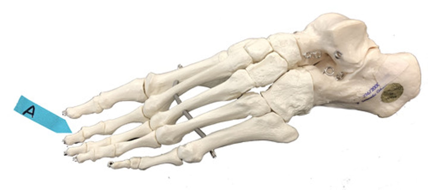 <p>Identify the bone (be specific).</p>