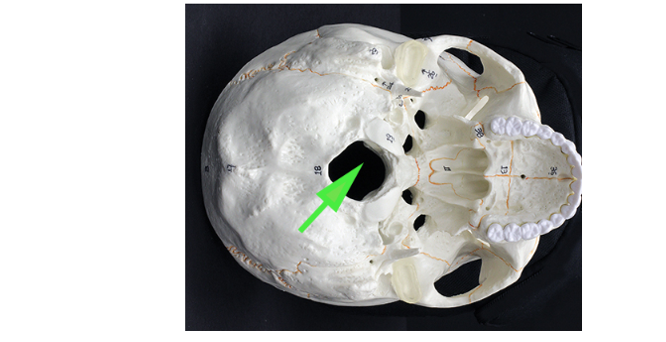 <p>What is the hole in the occipital bone called, as shown by the green arrow?</p>