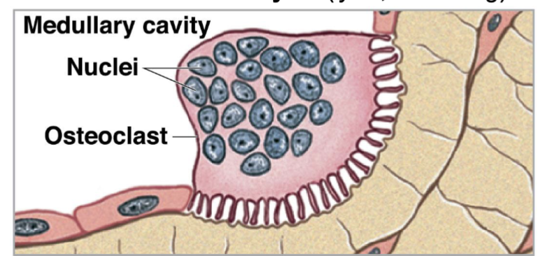 <p>Remove and remodel bone matrix.</p>