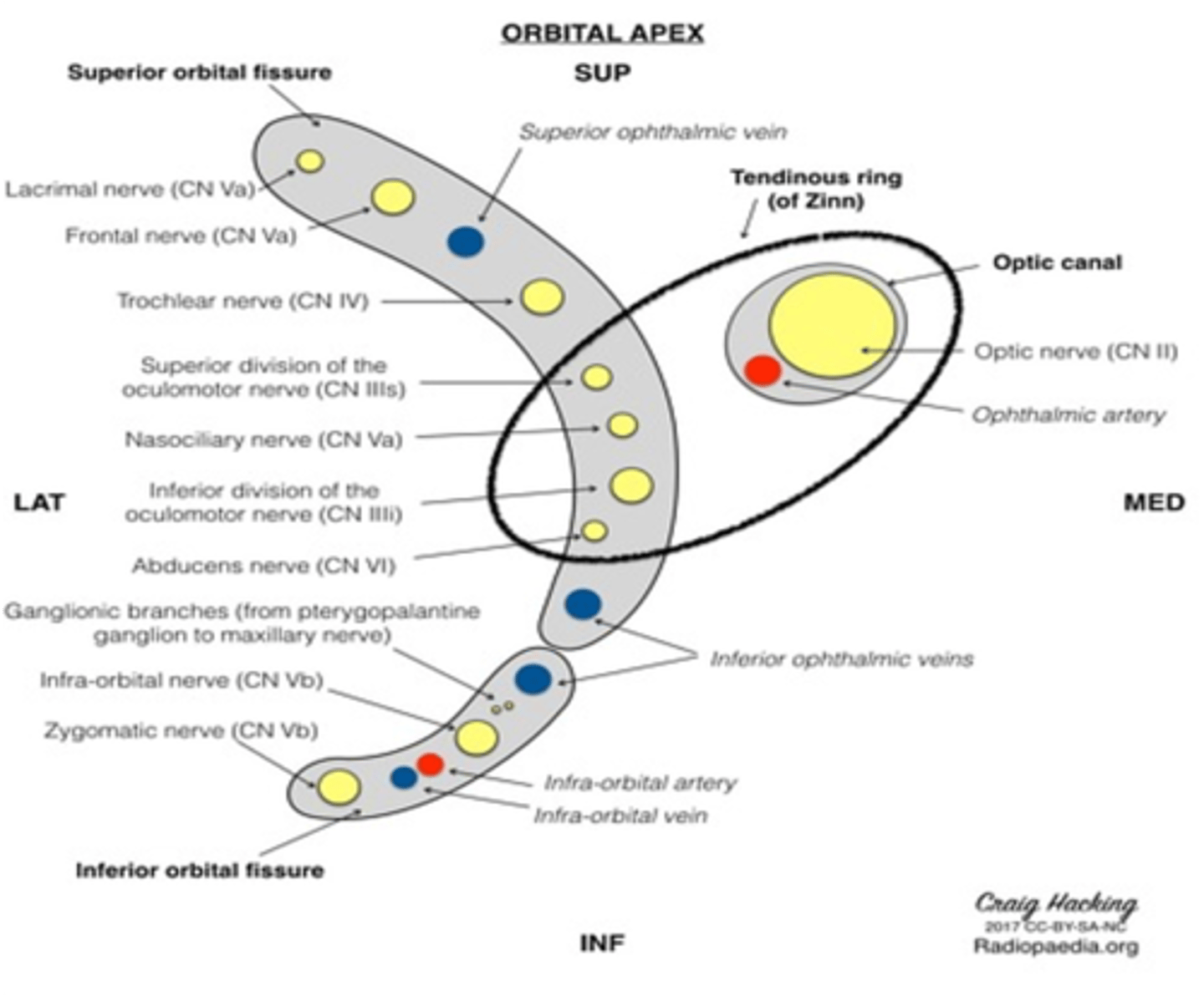 <p>Superior orbital fissure</p>