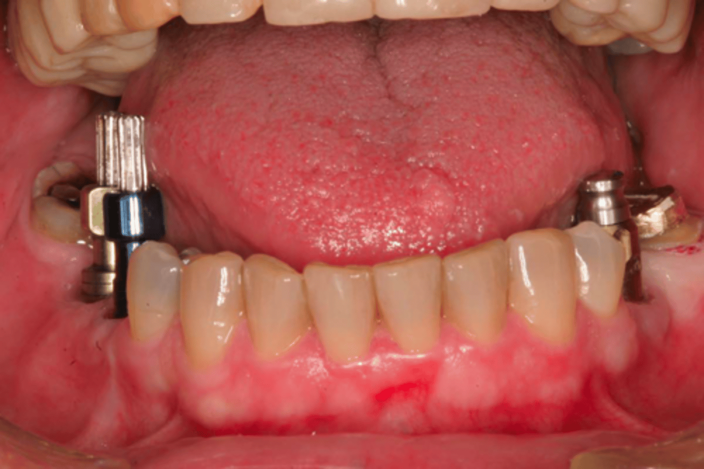 <p>ID the technique on the patient's left:</p>