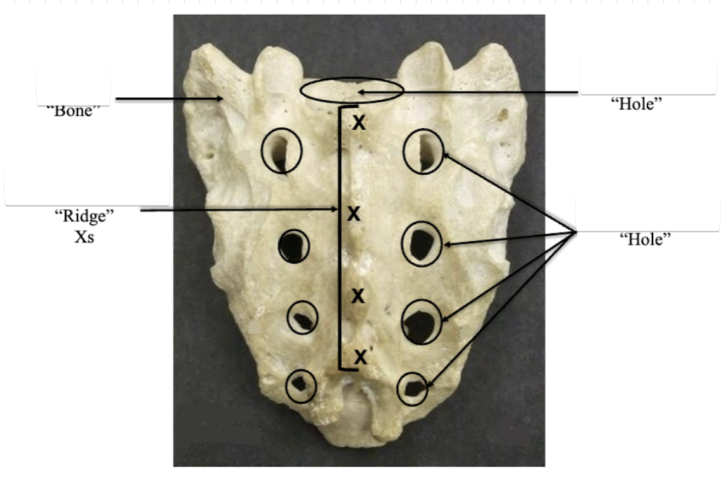 <p>Identify this bone</p>