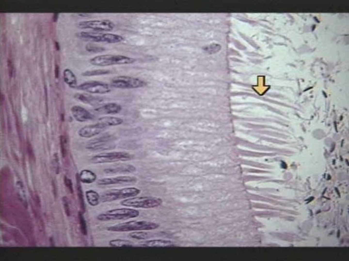 <p>hairlike structures that come out of Corti-sensory receptors for hearing</p>