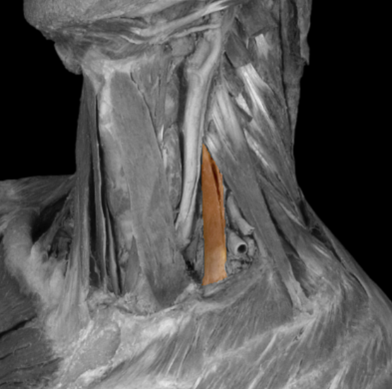 <p>What muscle is this? </p>