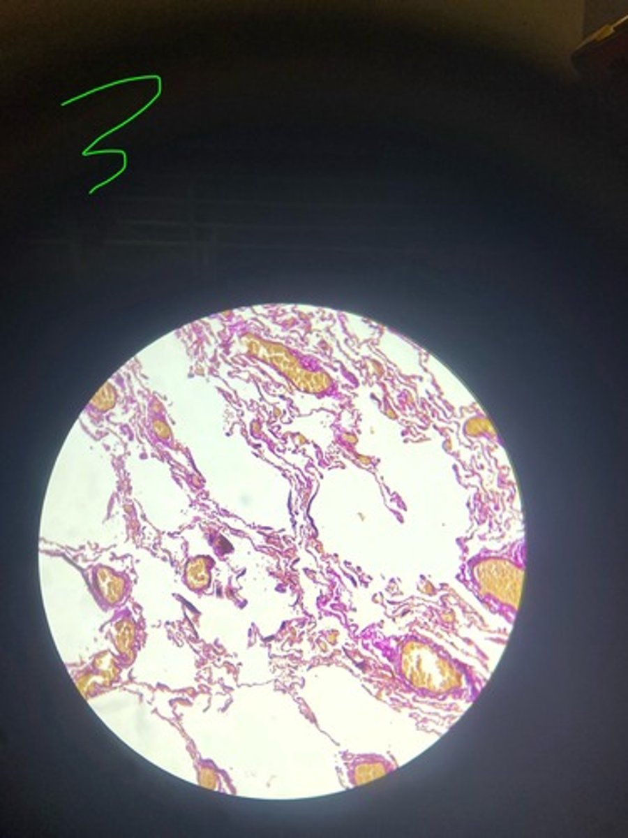 <p>What stain is this?</p>