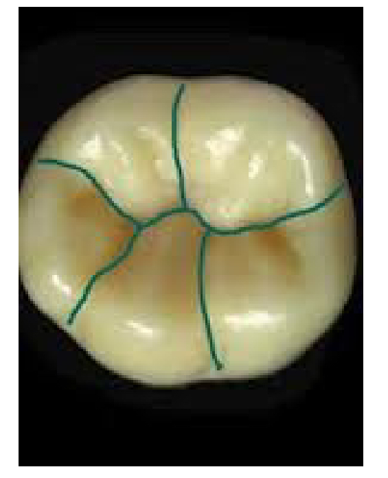<p>formed by uniting the crown of the tooth</p>