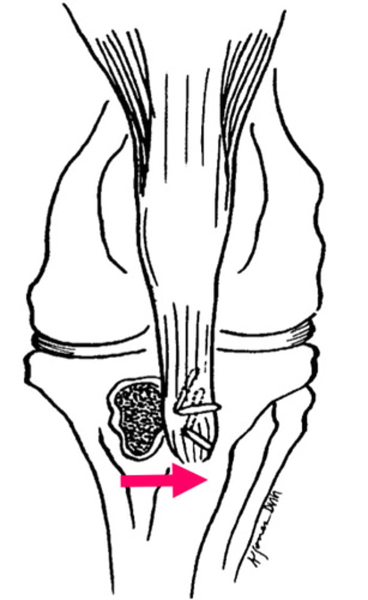 <p>Tibial tuberosity transposition for patellar luxation treatment - How do you do it?</p>