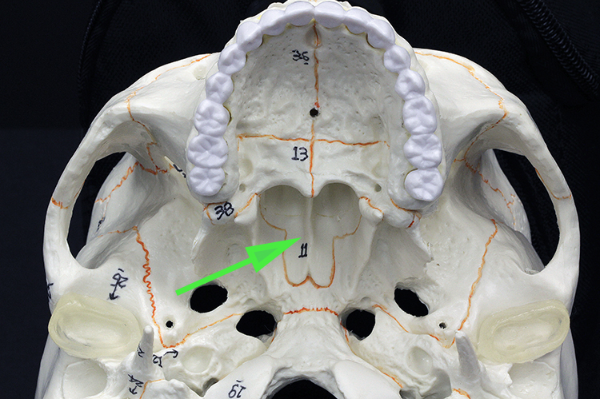 <p>What bone is marked by the green arrow?</p>