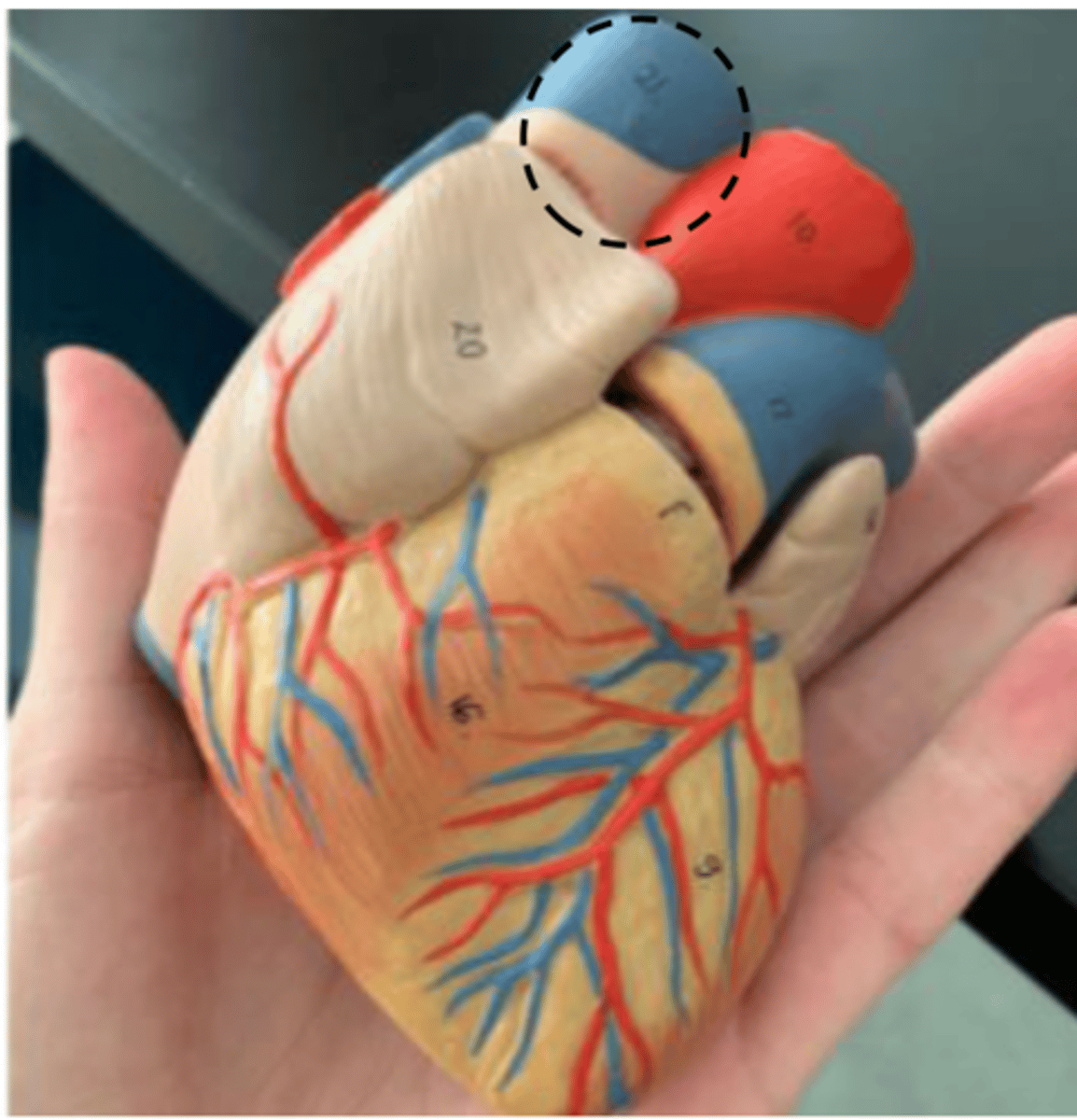 <p>inserts through the right atrium</p>