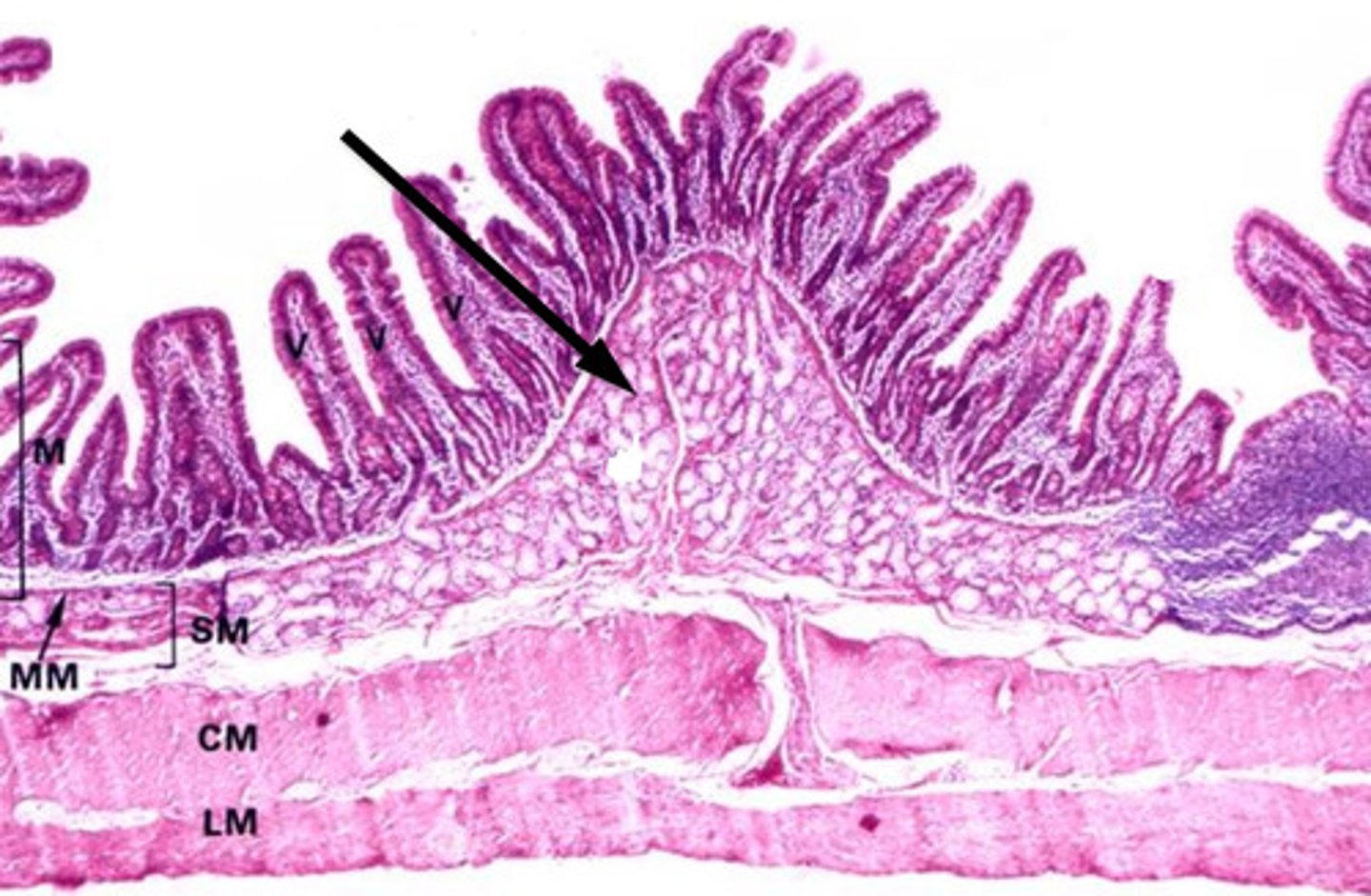 <p>Duodenal submucosal Brunner's Glands</p>
