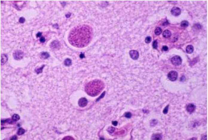 <p>what coccidia species causes this tissue cyst in fetal cow brain?</p>