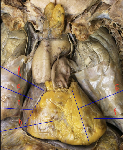 Anterior view of the heart 