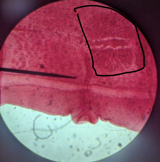 <p>what is circled on this mature proglottid</p>