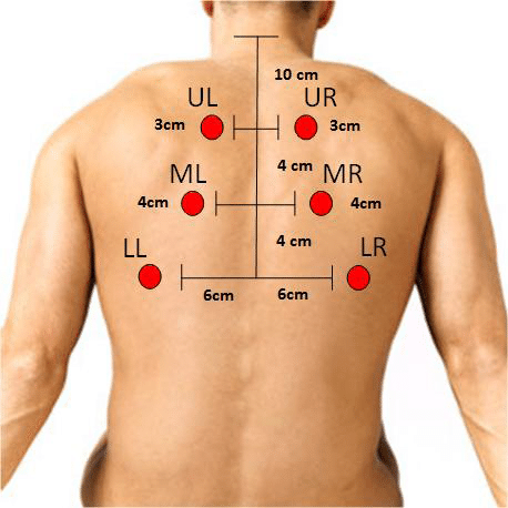 <p>auscultation x6 points (preferably on the back)</p>