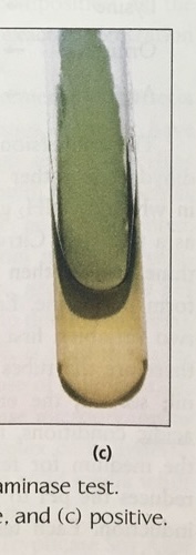 <p>what does it mean if phenylalanine is pos&nbsp;and color </p>