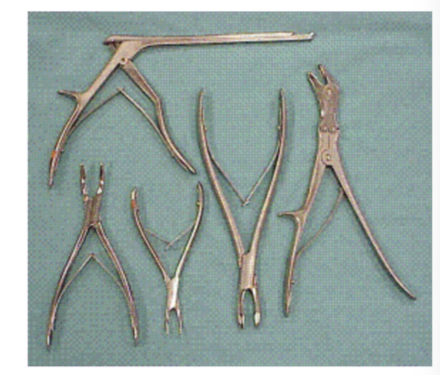 <p>This picture shows Rongeurs.</p>