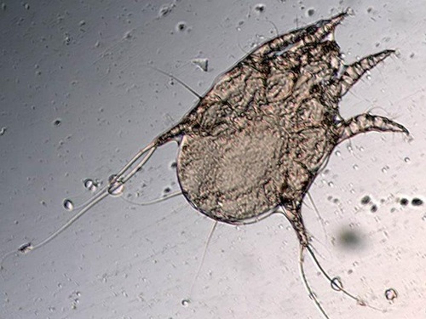 <p>A species classified as a scabies mite.</p>