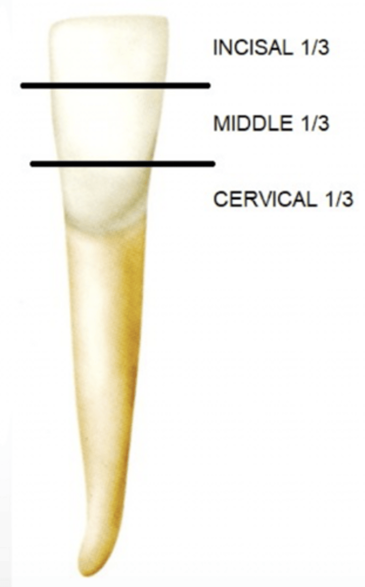 <p>- Incisal 1/3</p><p>- Middle 1/3</p><p>- Cervical 1/3</p>