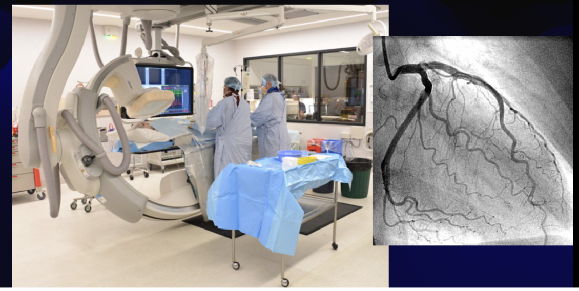 <p>the cardiac vessels are visualized by injecting the vessels with a contrast agent.</p>