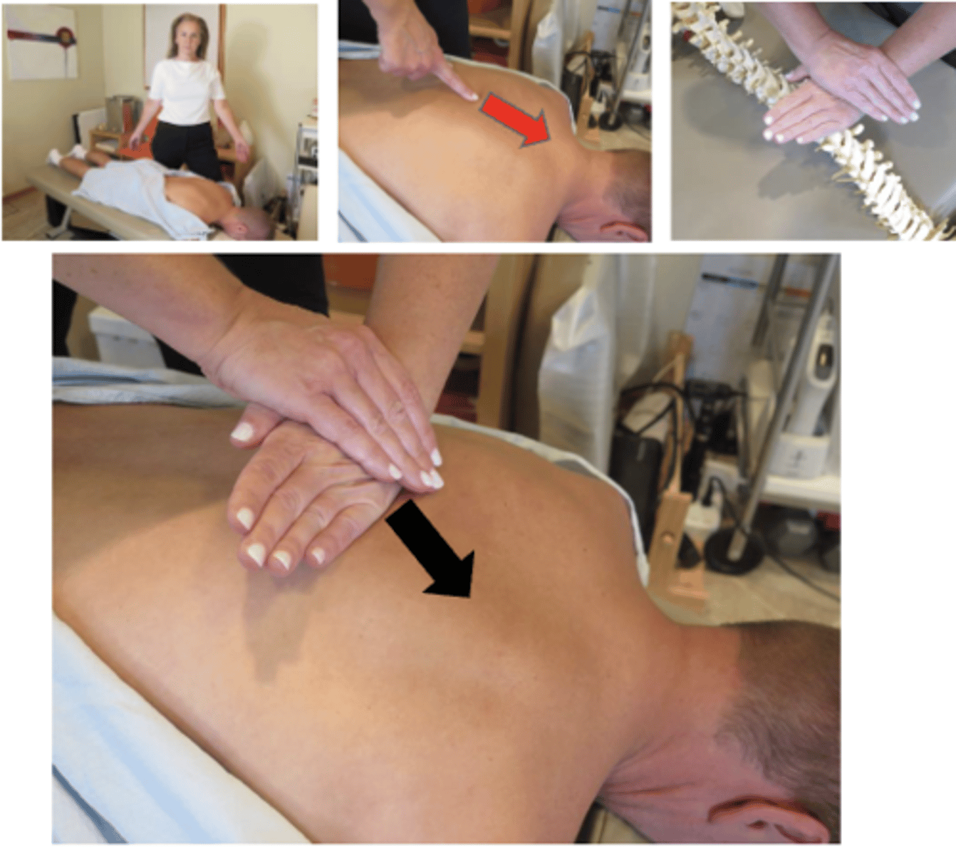 <p>• PP: Prone, headrest in flexion, asks permission to open gown/contact patient, verbalize finding the segment</p><p>• DP: Fencer stance, facing cephalad, center of gravity caudal to contact, drawing tissue slack inferior to superior</p><p>• CH: Mid-knife edge contact on the inferior edge of the superior spinous process</p><p>• IH: Calcaneal reinforcement with fingers pointing cephalad</p><p>• Vector: I-S with enough P-A to stay onSpinous Process (SP)</p>