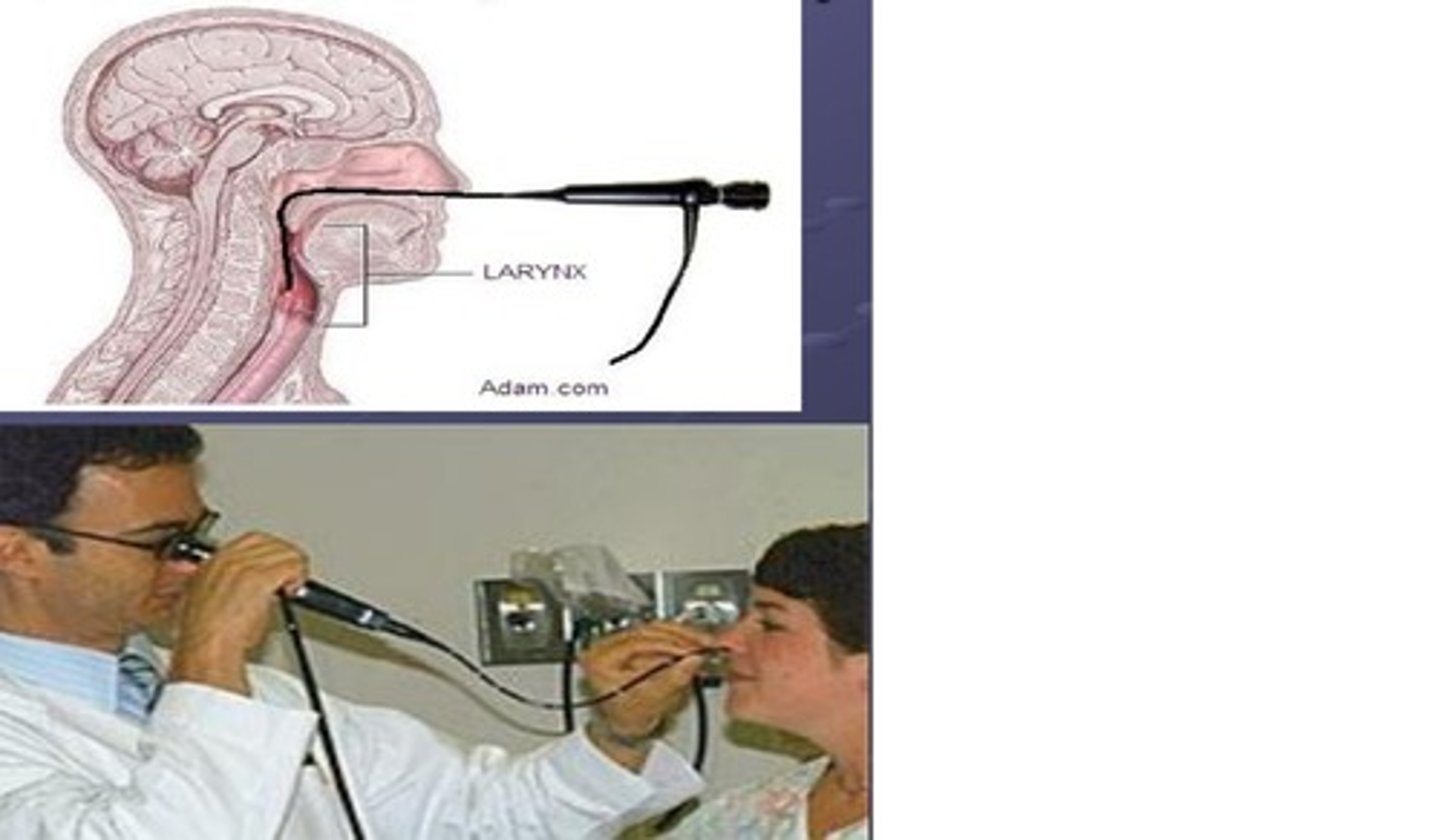 <p>visual examination of the larynx</p>
