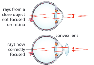 <p>They bring the light rays together so that they can be focused on the retina.</p>