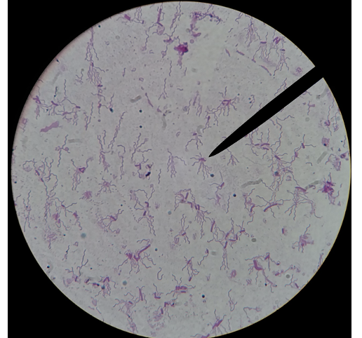 <p>What 2 diseases does this species cause?</p>