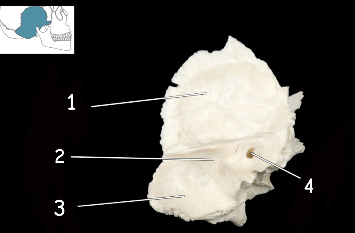 term image