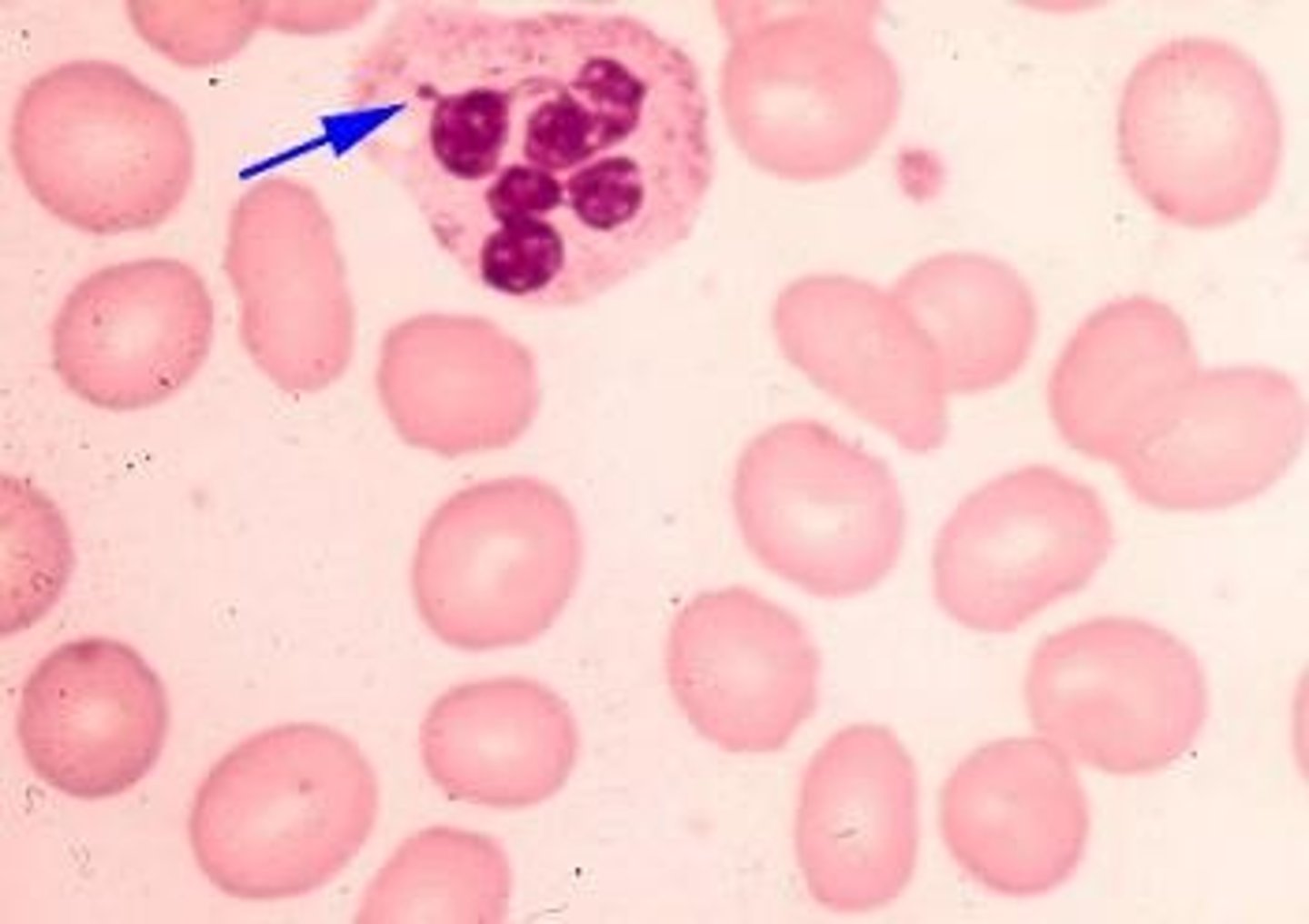 <p>True/False</p><p>The nuclear appendage at the tip of the arrow is a normal finding in females but not in males.</p>