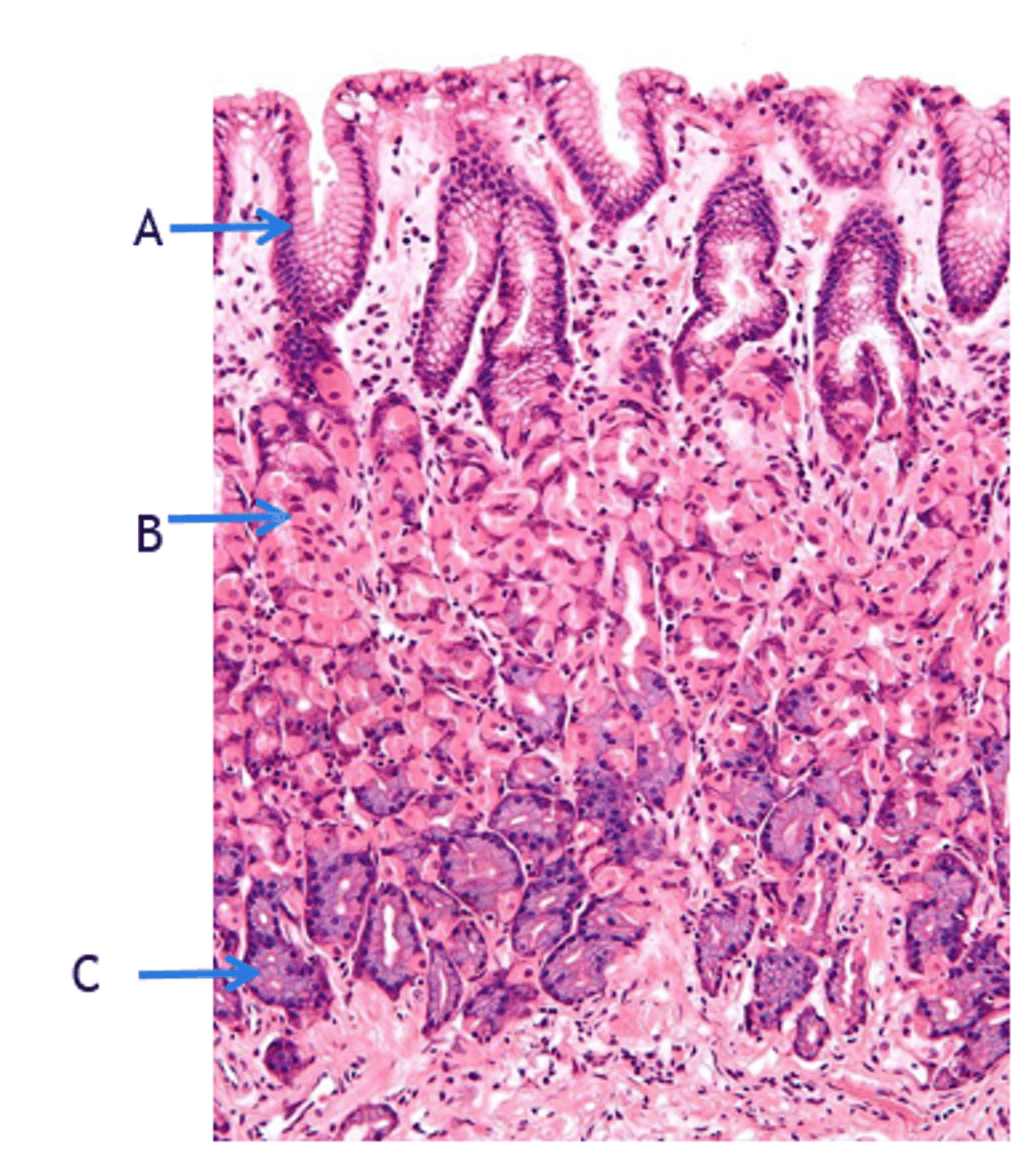 <p>What cells (A) secrete protective mucus in the cardia of stomach?</p>