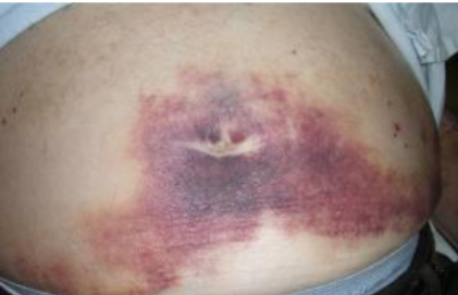 <p>What’s this called &amp; what’s it associated with</p>