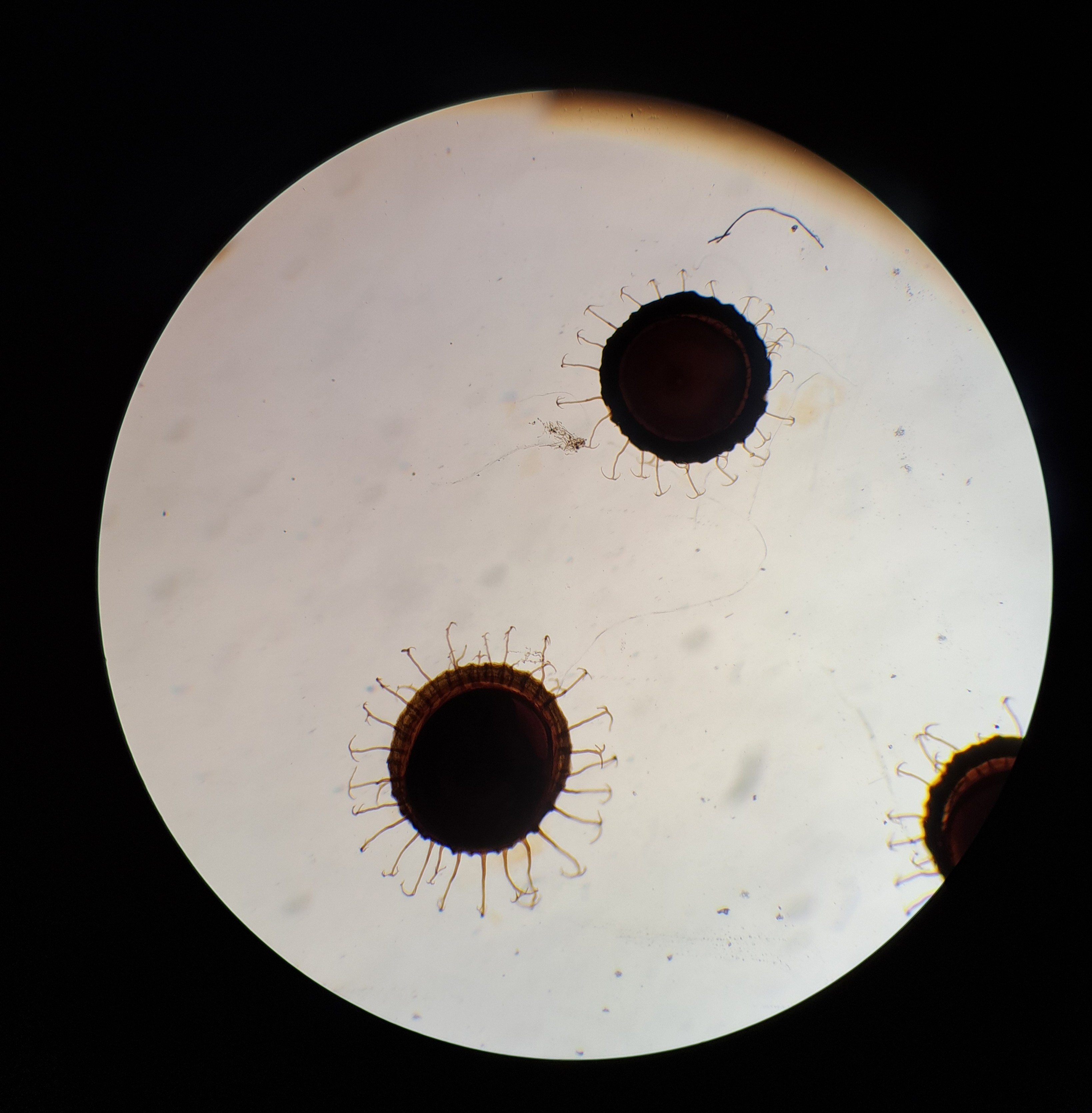 <p><em><span>Cristatella mucedo - </span></em><u><span>mechovka hadovitá</span></u></p><ul><li><p>statoblasty, preparáty v lihu</p></li></ul><p></p>