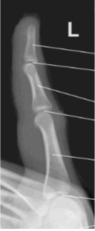 <p>What projection, position, and anatomy is this?</p>