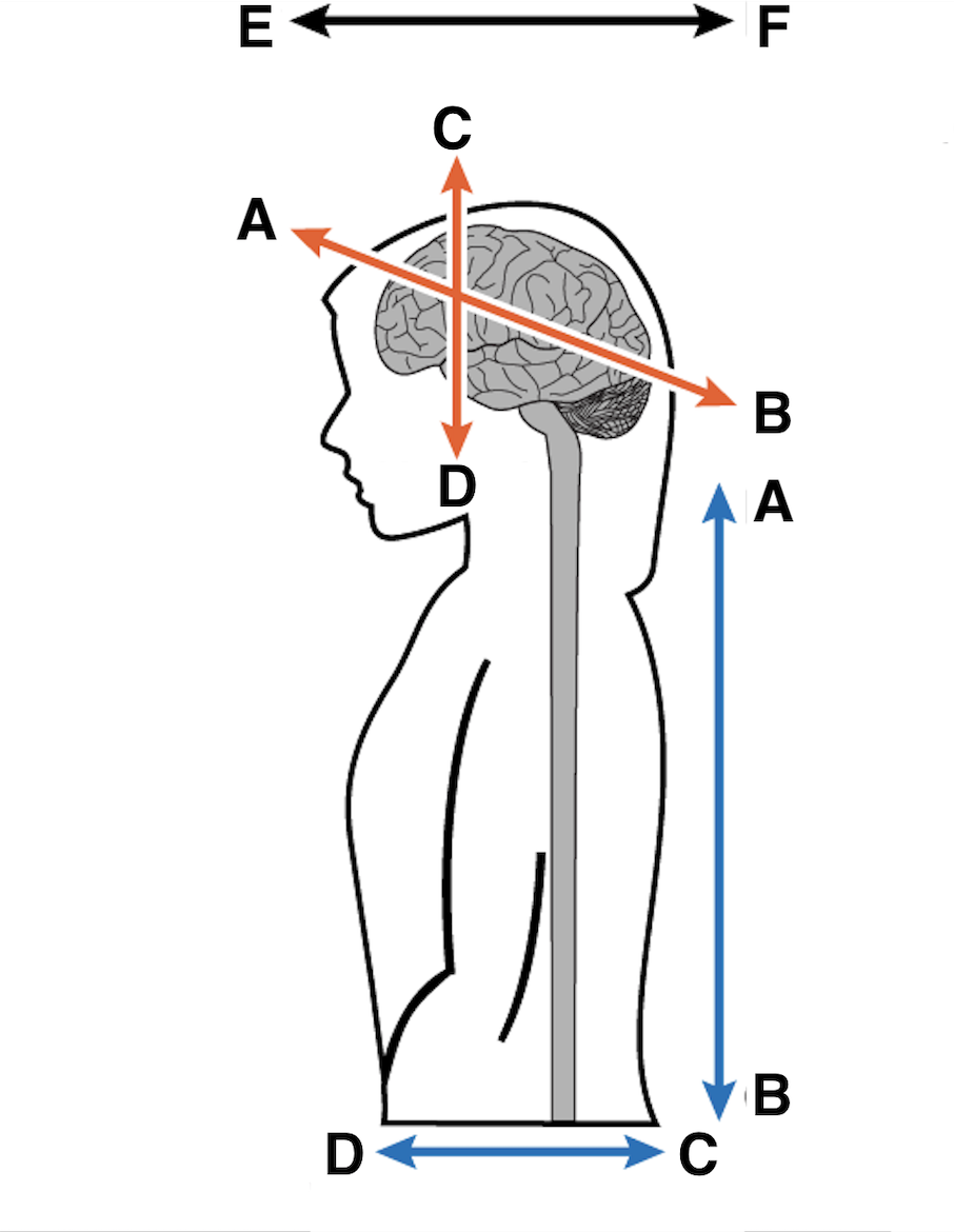 <p>E</p>