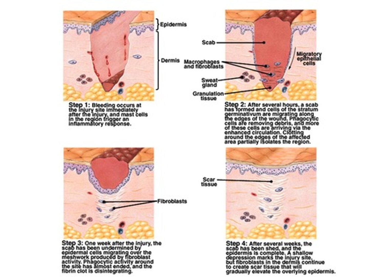 <p>Wound healing involves inflammation, migration phase, proliferative phase, and maturation phase.</p>